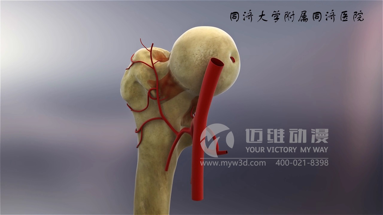 醫(yī)學(xué)仿真三維動(dòng)畫(huà)演示 醫(yī)學(xué)仿真三維動(dòng)畫(huà)演示