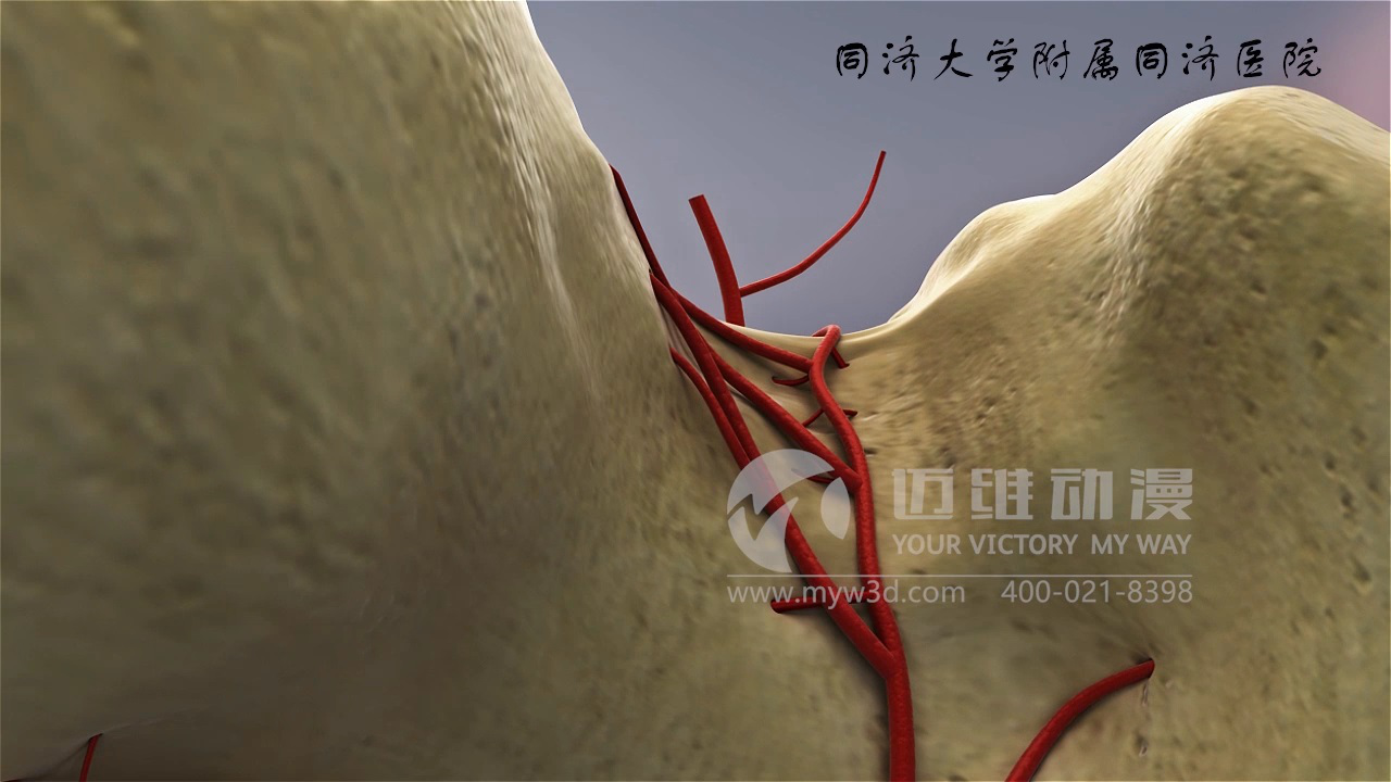 醫(yī)學(xué)仿真三維動(dòng)畫(huà)演示 醫(yī)學(xué)仿真三維動(dòng)畫(huà)演示