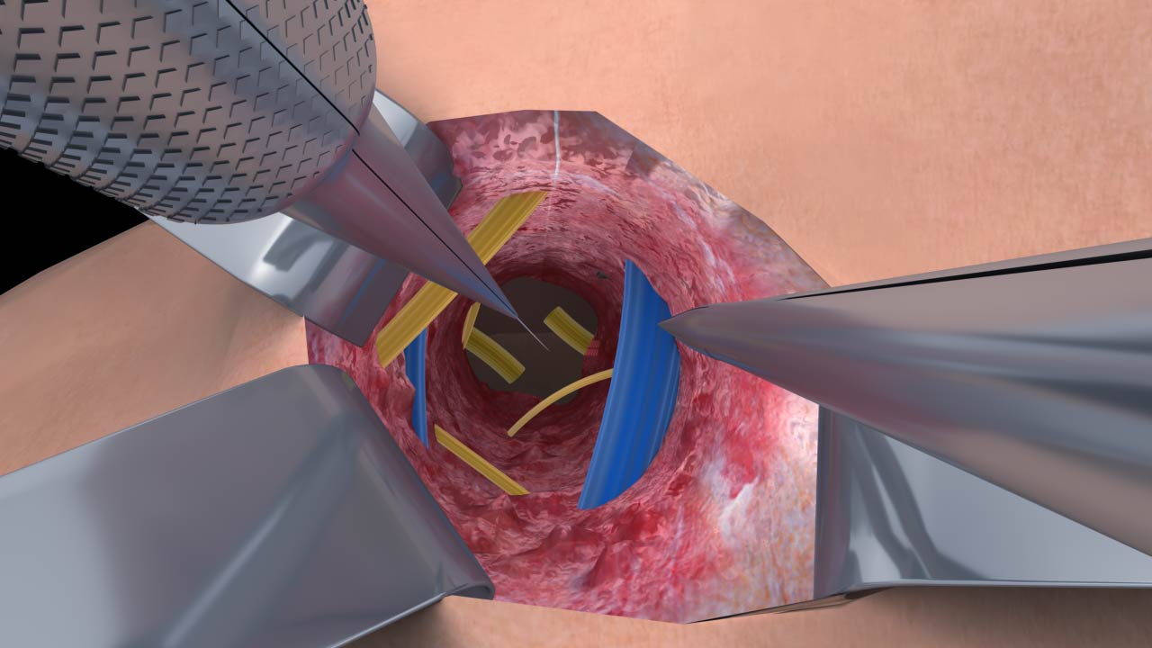 醫(yī)療醫(yī)學(xué)三維動(dòng)畫.jpg 醫(yī)療醫(yī)學(xué)三維動(dòng)畫.jpg