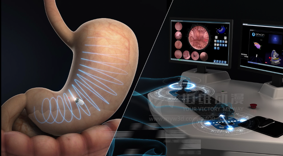醫(yī)用設(shè)備三維動畫制作好處有哪些？(圖3)