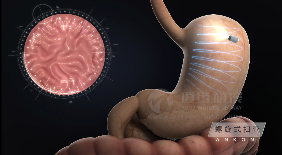 醫(yī)用設(shè)備三維動畫制作好處有哪些？(圖2)