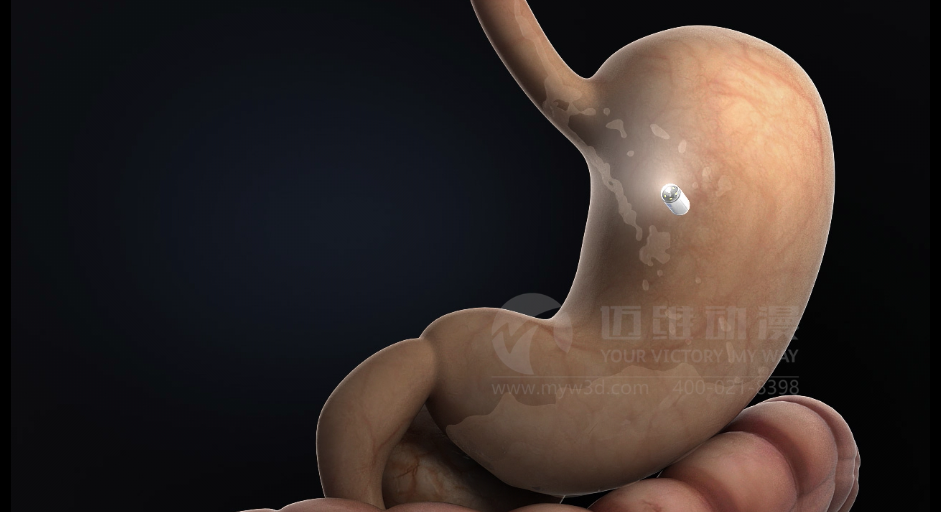 醫(yī)用設(shè)備三維動畫制作好處有哪些？(圖1)