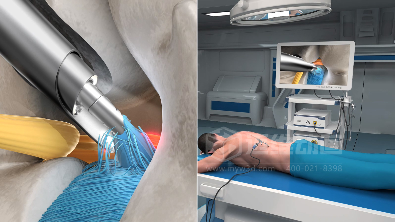 企業(yè)制作工程施工|自動化生產(chǎn)線|產(chǎn)品演示|醫(yī)學(xué)行業(yè)三維動畫要準備哪些資料，以便有效地提供給三維動畫制作公司呢？(圖7)