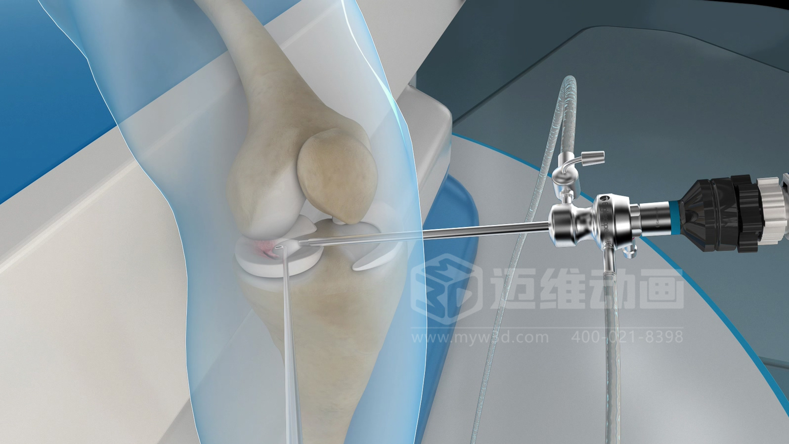 醫(yī)學(xué)手術(shù)三維動畫制作公司哪家好？解碼上海邁維動漫的醫(yī)學(xué)醫(yī)療3D可視化創(chuàng)新之路(圖1)