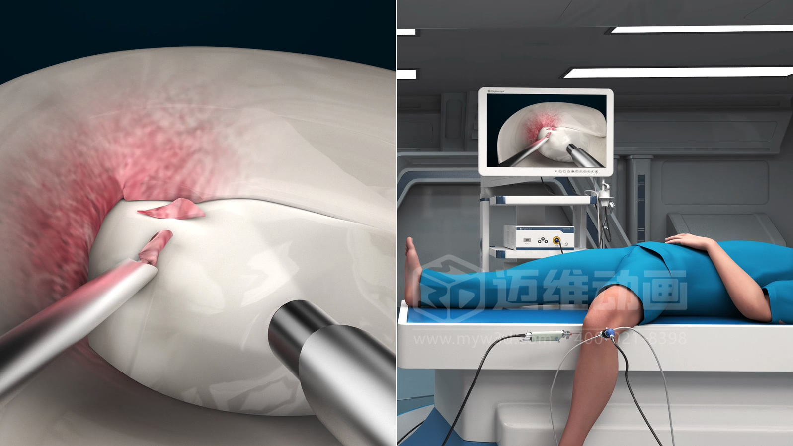 醫(yī)學(xué)手術(shù)三維動畫制作公司哪家好？解碼上海邁維動漫的醫(yī)學(xué)醫(yī)療3D可視化創(chuàng)新之路(圖2)