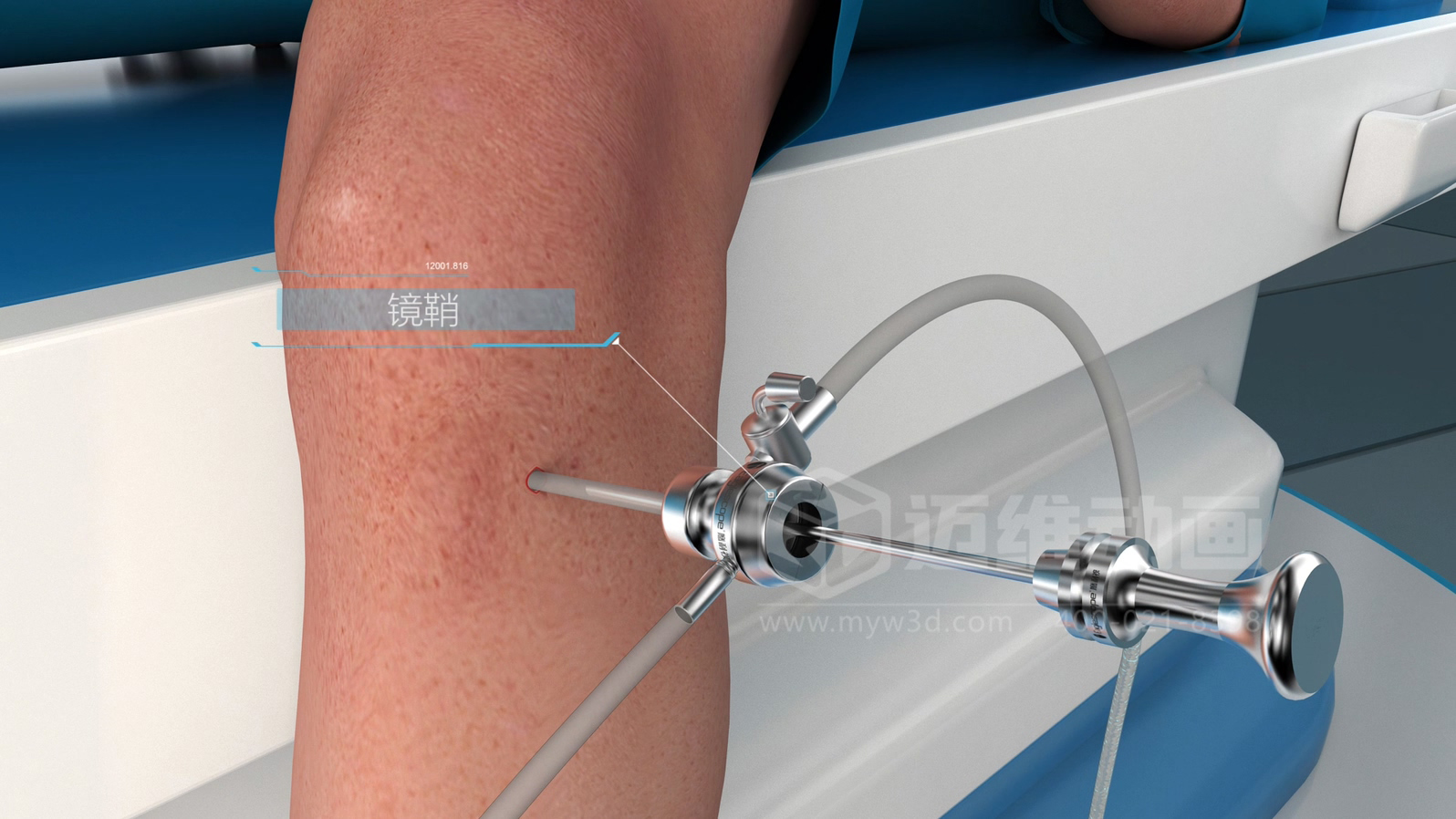 醫(yī)學(xué)手術(shù)三維動畫制作公司哪家好？解碼上海邁維動漫的醫(yī)學(xué)醫(yī)療3D可視化創(chuàng)新之路(圖2)