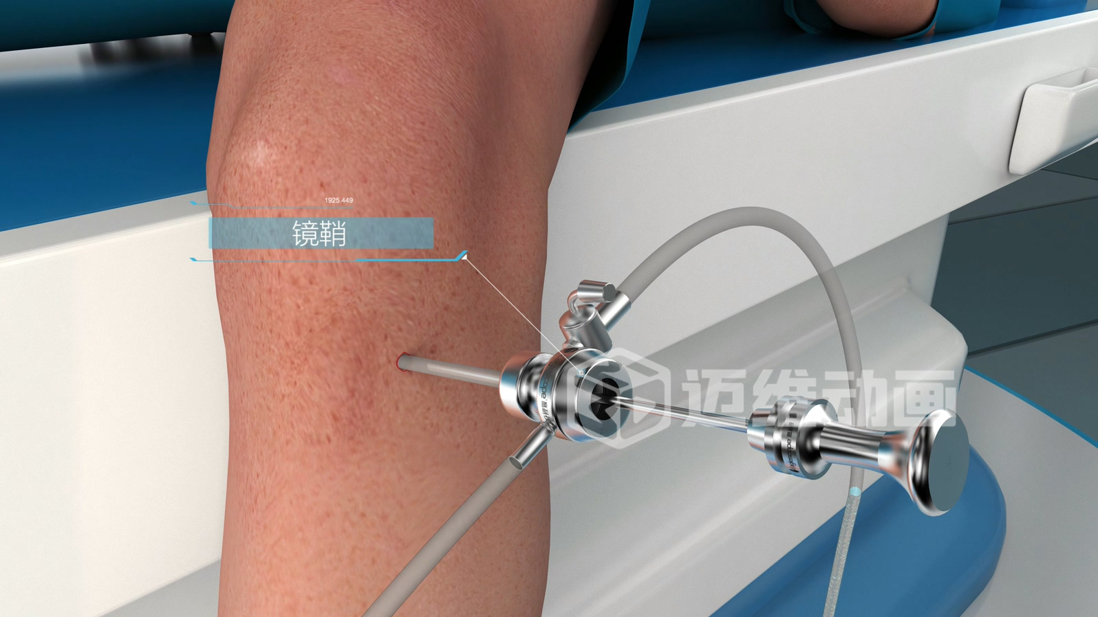 關(guān)節(jié)鏡手術(shù)三維動(dòng)畫(huà)