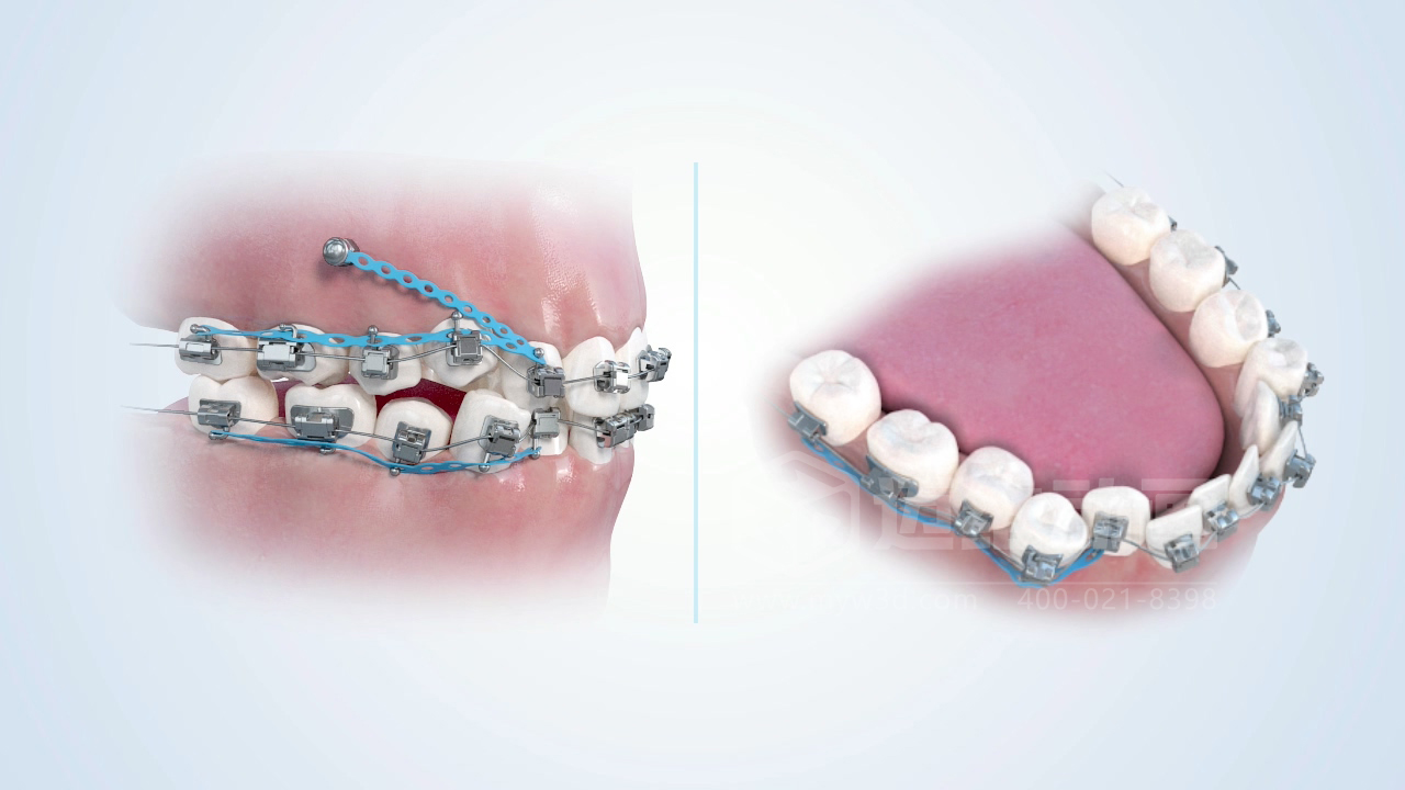 從實(shí)驗(yàn)室到手術(shù)室：邁維動(dòng)漫用三維動(dòng)畫，讓精密科技“看得見，懂得到”訂單轉(zhuǎn)化率提高 50%(圖10)