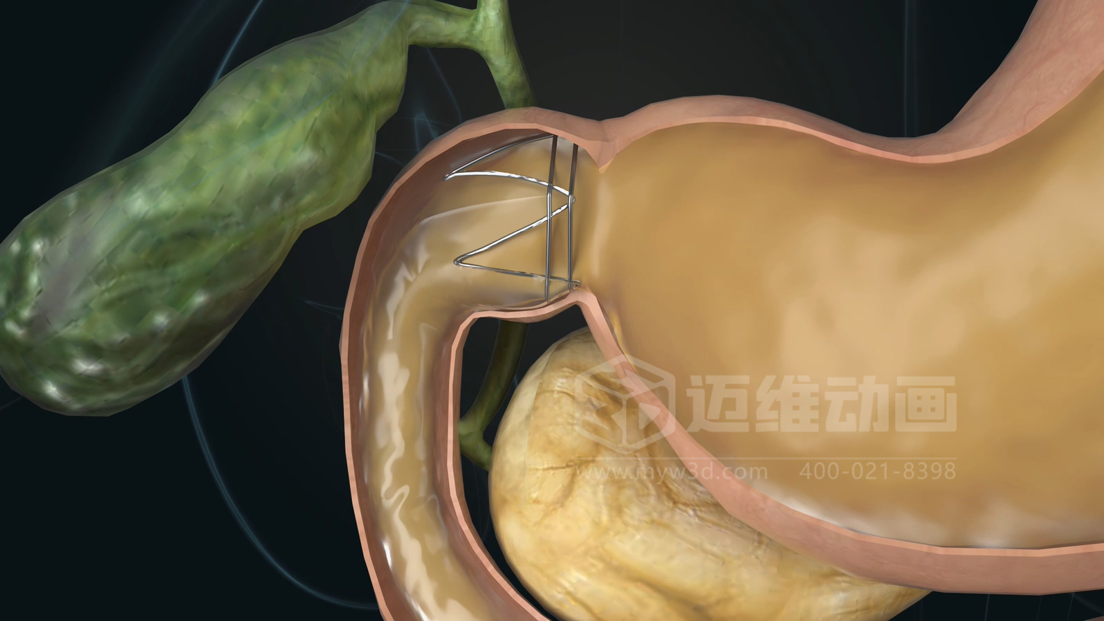 醫(yī)學科普從來不是 “天書”：三維動畫讓復雜科學原理輕松 get！(圖12)