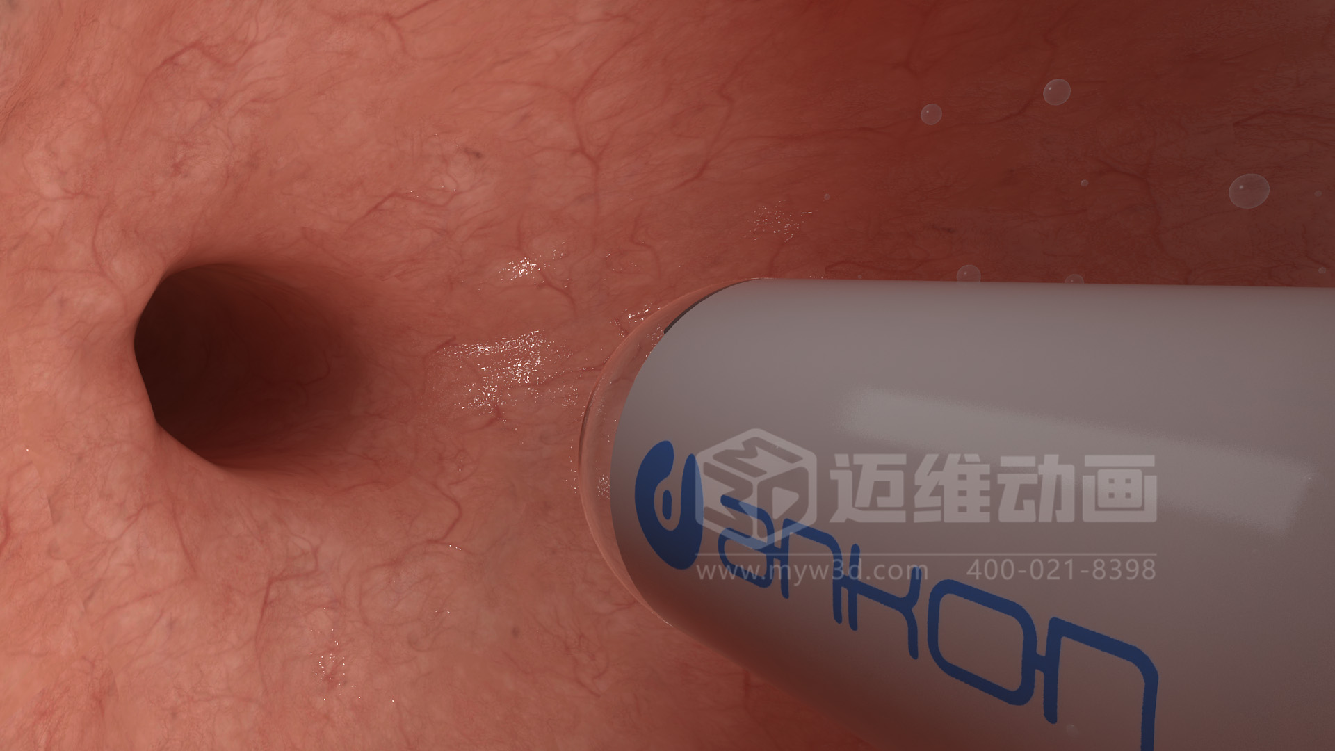 醫(yī)學(xué)檢測設(shè)備如何突破消化道檢查壁壘？三維動畫還原核心技術(shù)與臨床價值(圖4)